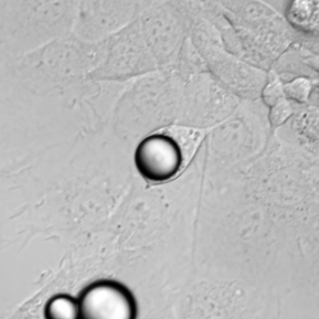 Microscopy image of an elastomer bead inside a cell.